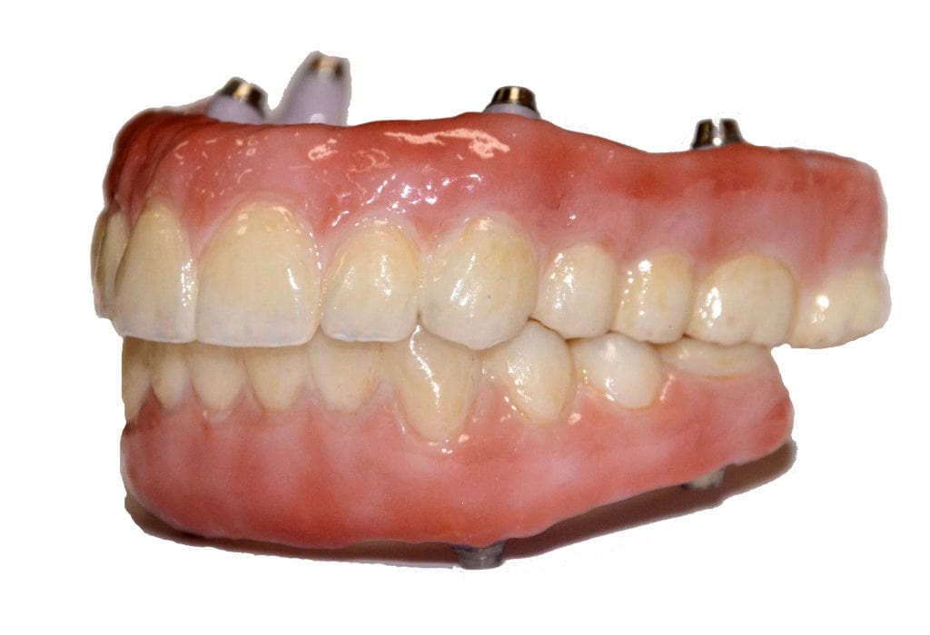 prosthodontics
